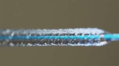  Nitinol: Una Maravilla Metálica para Implantes y Actuationes Precisas!